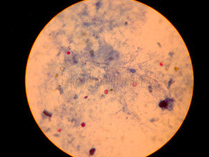 Prevention is Better than Cure: Filter Drinking Water to Remove Disease Causing Microbial Cysts