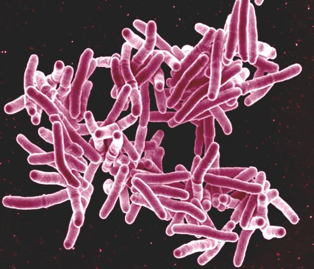 Can a Mother's Exposure to Chemicals Make Their Baby Vulnerable to TB?
