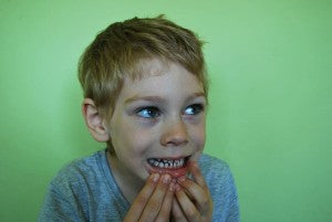 Exposure to PFAS Chemical in Drinking Water Increases Risk of Cavities in Children