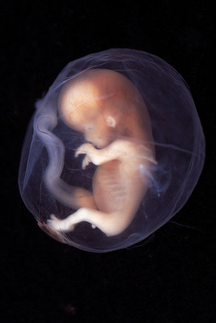 Environmental Toxins Affect Developing Fetus