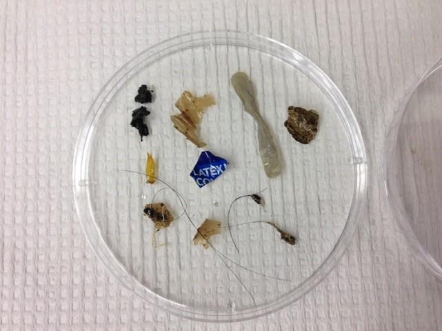 Wastewater Treatment Facilities Release Significant Amounts of Microplastics into Rivers