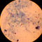 Prevention is Better than Cure: Filter Drinking Water to Remove Disease Causing Microbial Cysts