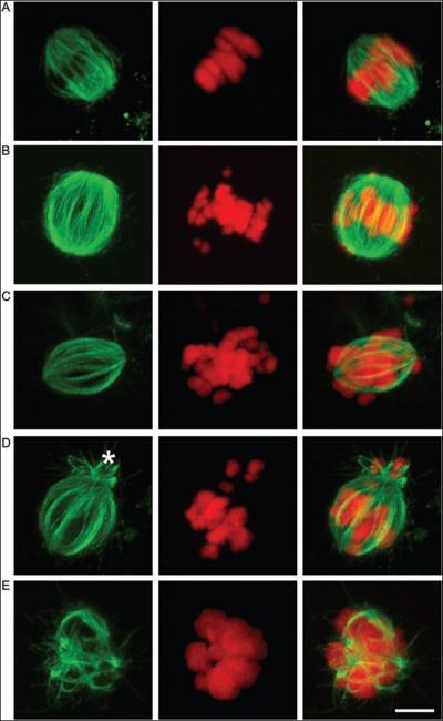 Images of eggs examined in this study show a properly formed spindle structure with aligned chromosomes (image A) and eggs with spindles of various abnormal shapes and misaligned chromosomes after being exposed to BPA (images B, C, D and E). The green images on the left are the eggs' spindle, the red center images are the eggs' chromosomes and the images on the right show the spindles and chromosomes merged together. Credit: Brigham and Women's Hospital