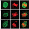 Human Egg Maturation Disrupted by BPA Exposure