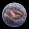 Do Berkey Filters Remove Cryptosporidium From Drinking Water