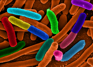 E. coli Bacterial Contamination: What are the Health Risks?