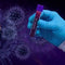 The Link Between Environmental Contaminants and Severe COVID-19