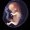 Environmental Toxins Affect Developing Fetus